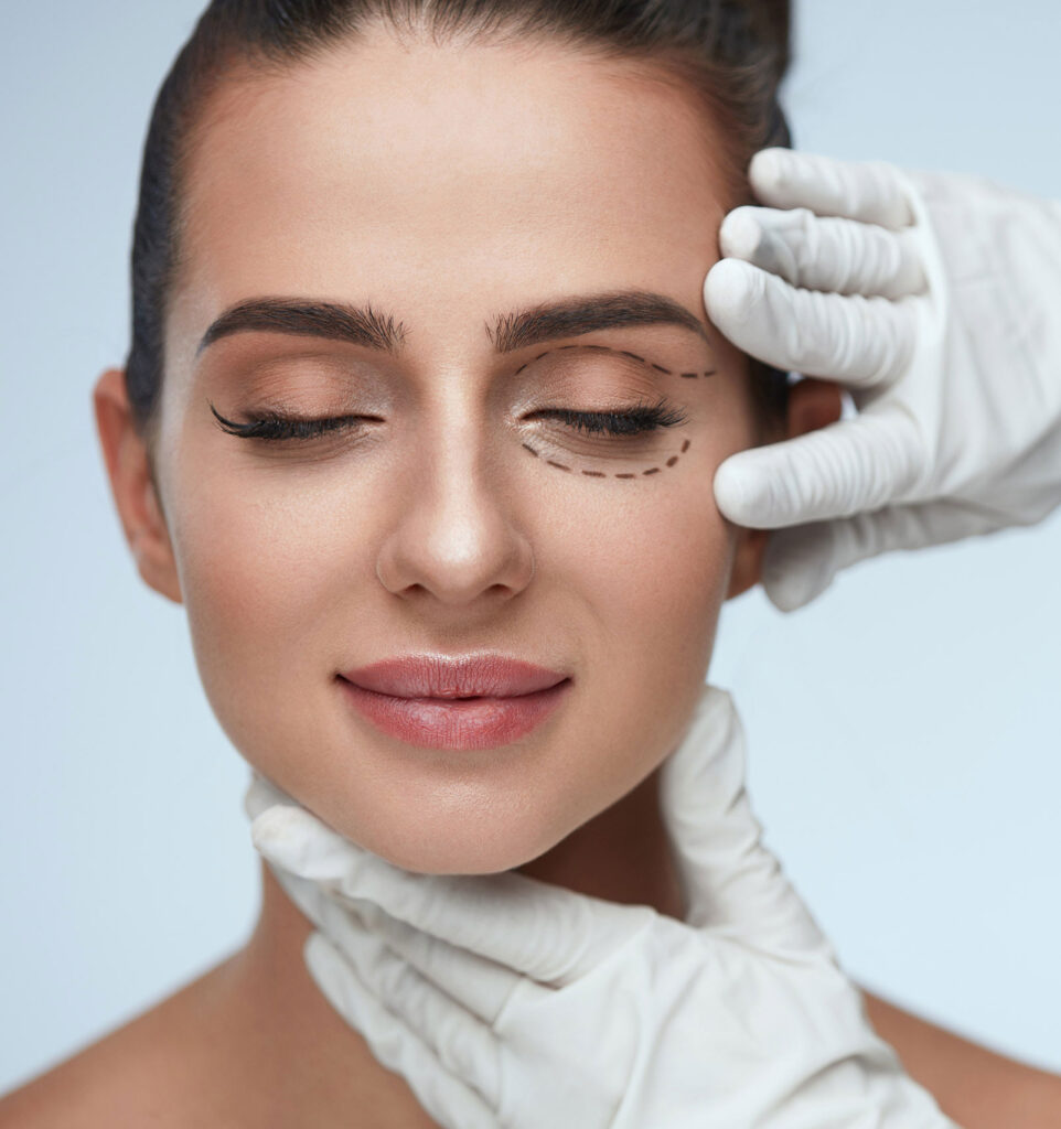 young woman with correction marks around her left eye preparing for plastic surgery