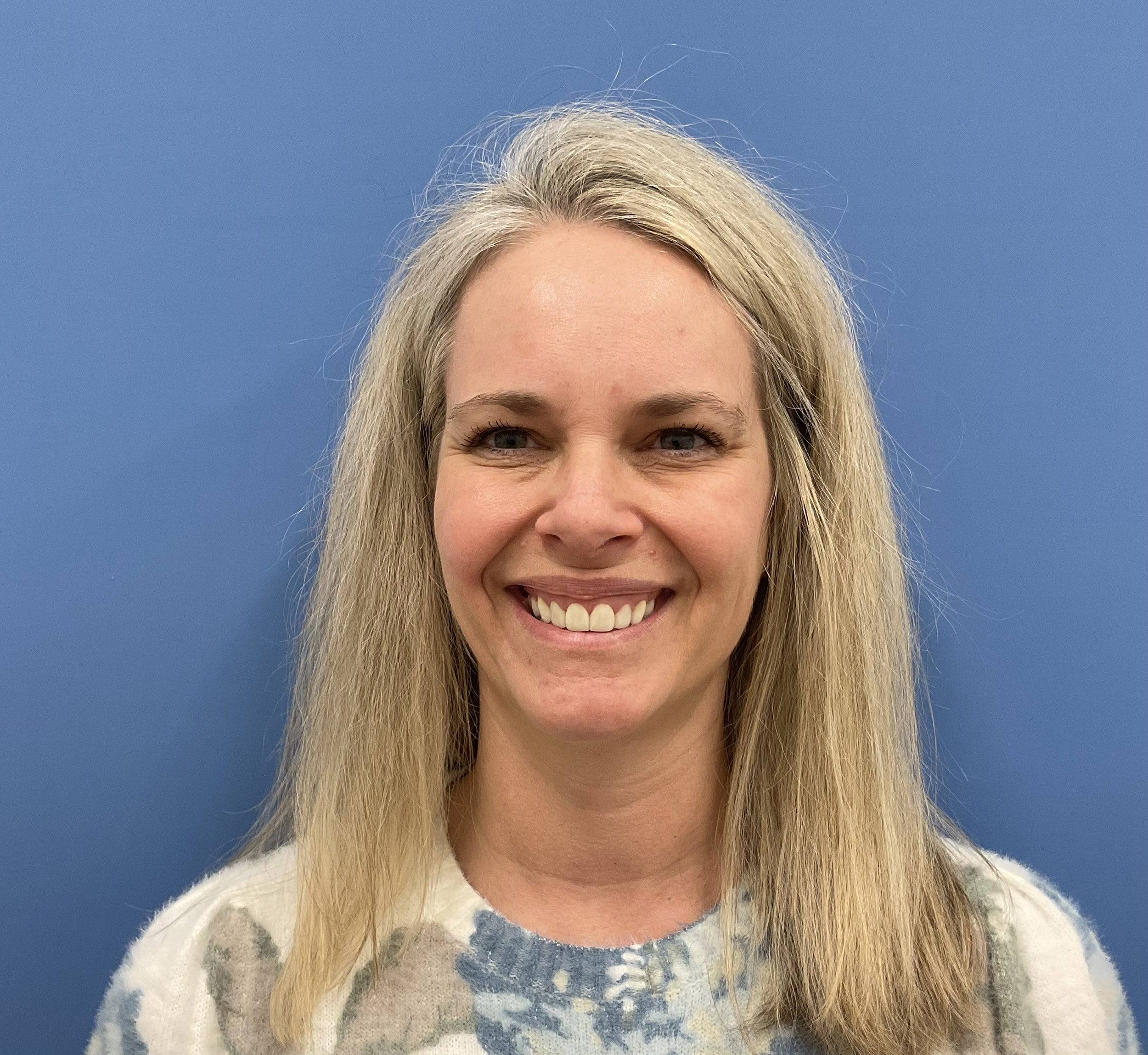 Botox – Patient 15 Before